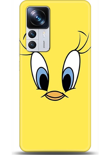 Xiaomi Mi 12T Pro Kılıf Hd Baskılı Kılıf - Followed Institution 0080
