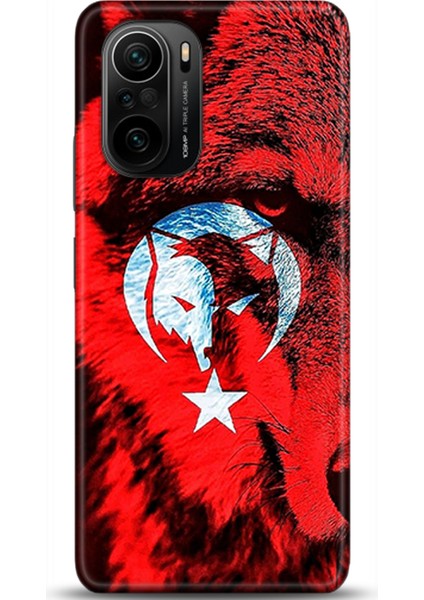 Xiaomi Mi 11i Kılıf Hd Baskılı Kılıf - Followed Institution 0469