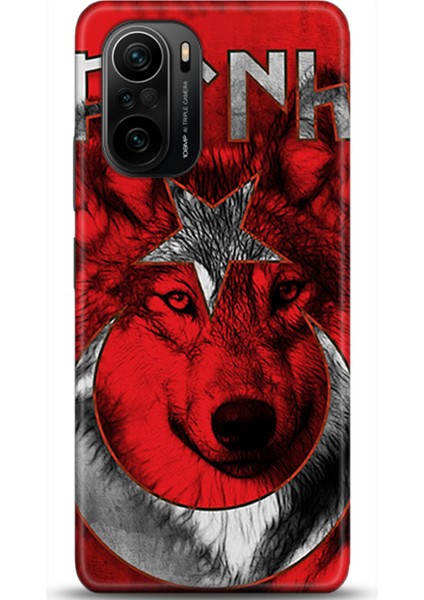 Xiaomi Mi 11i Kılıf Hd Baskılı Kılıf - Followed Institution 0470