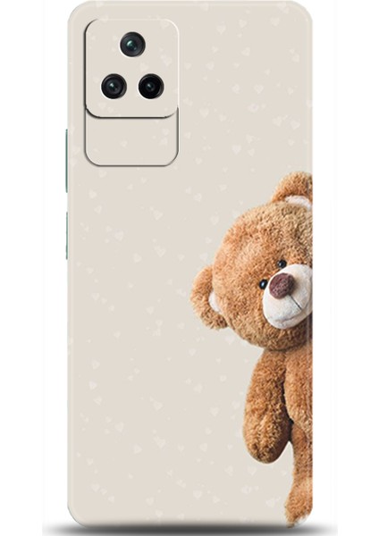 Xiaomi Poco F4 Kılıf Hd Baskılı Kılıf - Followed Institution 0005