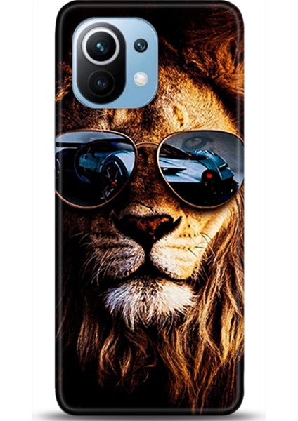 Xiaomi Mi 11 Kılıf Hd Baskılı Kılıf - Followed Institution 0616