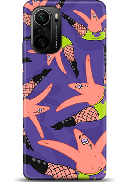 Xiaomi Poco F3 Kılıf Hd Baskılı Kılıf - Followed Institution 0566