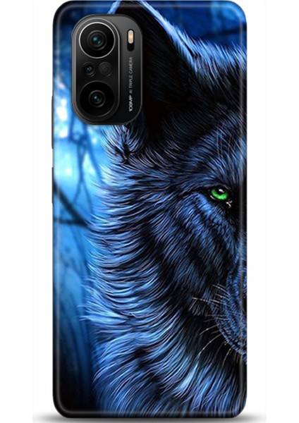 Xiaomi Mi 11i Kılıf Hd Baskılı Kılıf - Followed Institution 0136