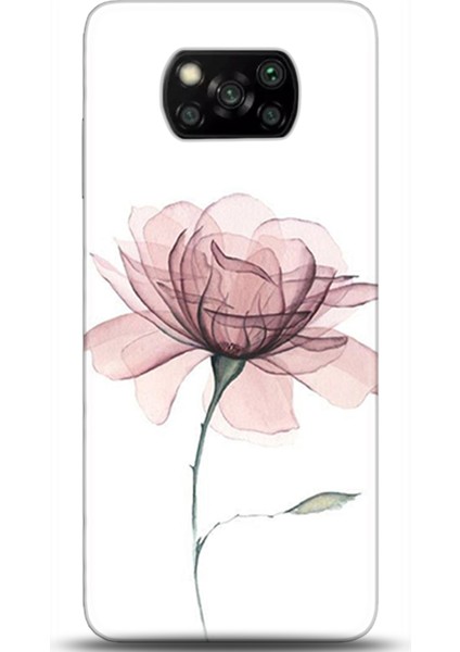 Xiaomi Poco X3 Pro Kılıf Hd Baskılı Kılıf - Followed Institution 0309