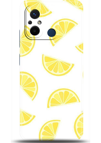 Xiaomi Redmi 12C Kılıf Hd Baskılı Kılıf - Followed Institution 0105