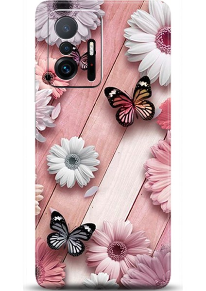 Xiaomi Mi 11T Pro Kılıf Hd Baskılı Kılıf - Followed Institution 0641