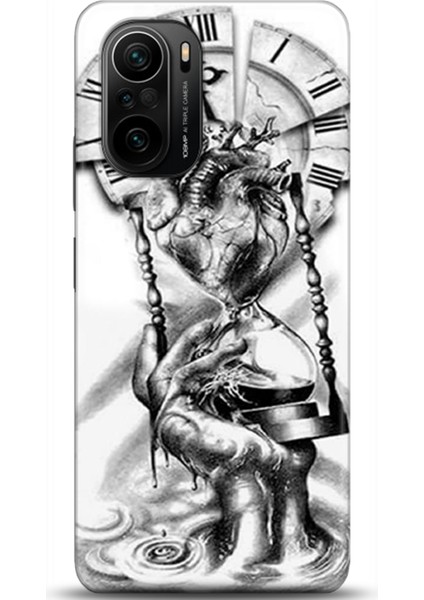 Xiaomi Mi 11i Kılıf Hd Baskılı Kılıf - Followed Institution 0232