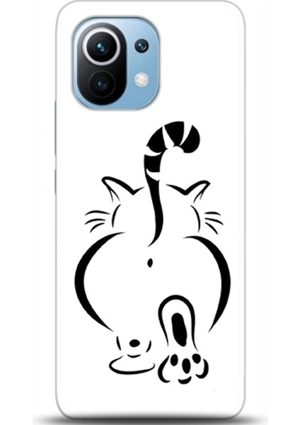 Xiaomi Mi 11 Kılıf Hd Baskılı Kılıf - Followed Institution 0666