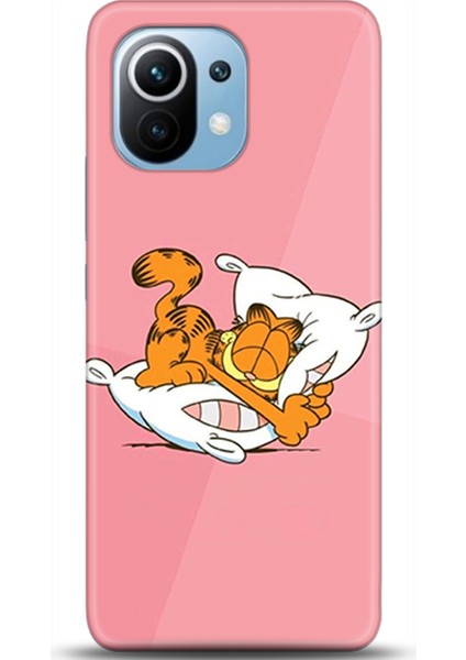 Xiaomi Mi 11 Kılıf Hd Baskılı Kılıf - Followed Institution 0400