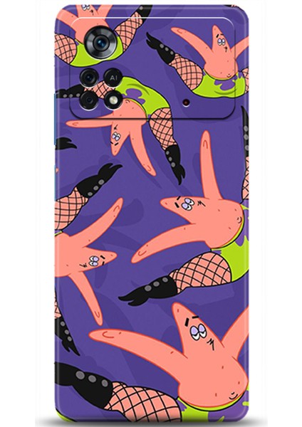 Xiaomi Poco X4 Pro 5g Kılıf Hd Baskılı Kılıf - Followed Institution 0566