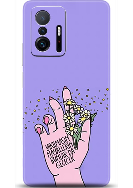 Xiaomi Mi 11T Kılıf Hd Baskılı Kılıf - Followed Institution 0427