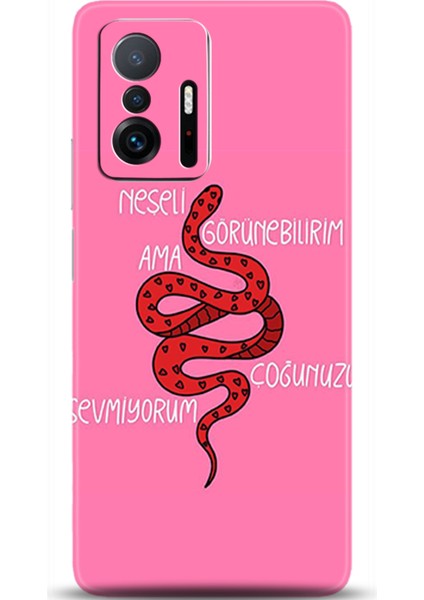 Xiaomi Mi 11T Kılıf Hd Baskılı Kılıf - Followed Institution 0037