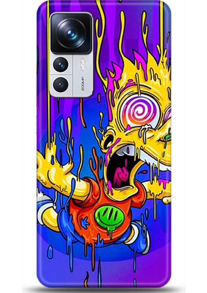 Xiaomi Mi 12T Pro Kılıf Hd Baskılı Kılıf - Followed Institution 0158