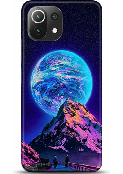 Xiaomi Mi 11 Lite Kılıf Hd Baskılı Kılıf - Followed Institution 0052