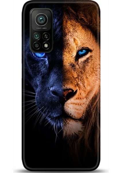 Xiaomi Mi 10T Pro Kılıf Hd Baskılı Kılıf - Followed Institution 0045