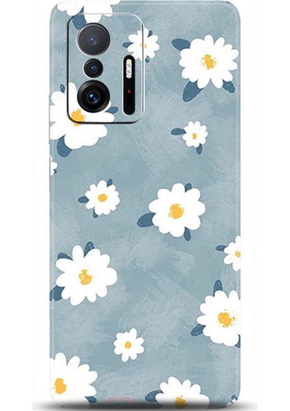 Xiaomi Mi 11T Kılıf Hd Baskılı Kılıf - Followed Institution 0134
