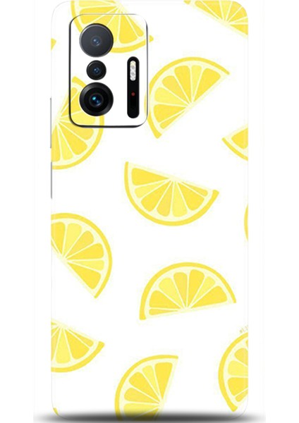 Xiaomi Mi 11T Kılıf Hd Baskılı Kılıf - Followed Institution 0105