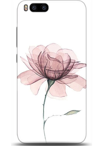 Xiaomi Mi 6 Kılıf Hd Baskılı Kılıf - Followed Institution 0309
