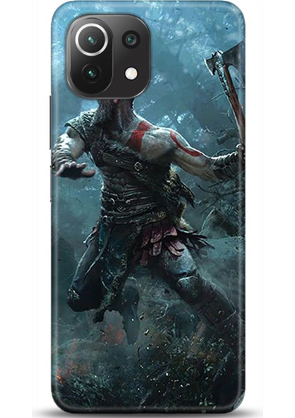 Xiaomi Mi 11 Lite Kılıf Hd Baskılı Kılıf - Followed Institution 0212
