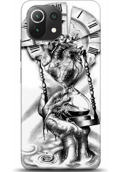 Xiaomi Mi 11 Lite Kılıf Hd Baskılı Kılıf - Followed Institution 0232