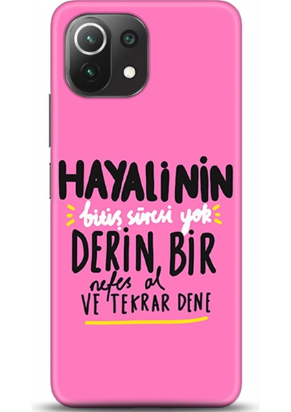 Xiaomi Mi 11 Lite Kılıf Hd Baskılı Kılıf - Followed Institution 0423