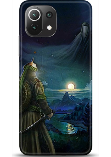 Xiaomi Mi 11 Lite Kılıf Hd Baskılı Kılıf - Followed Institution 0412