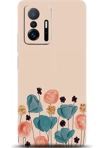 Xiaomi Mi 11T Kılıf Hd Baskılı Kılıf - Followed Institution 0359