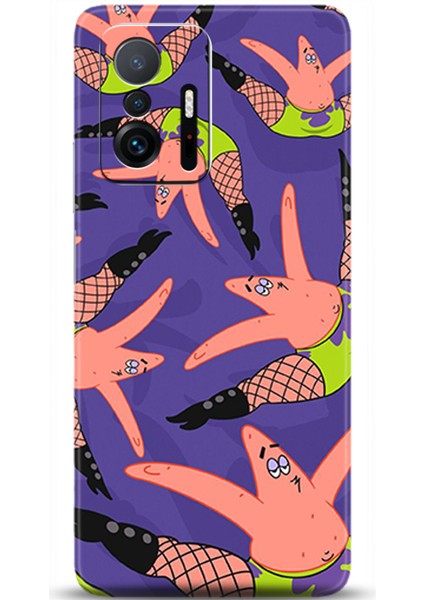 Xiaomi Mi 11T Kılıf Hd Baskılı Kılıf - Followed Institution 0566