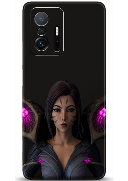 Xiaomi Mi 11T Kılıf Hd Baskılı Kılıf - Followed Institution 0108