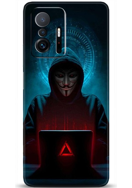 Xiaomi Mi 11T Kılıf Hd Baskılı Kılıf - Followed Institution 0378