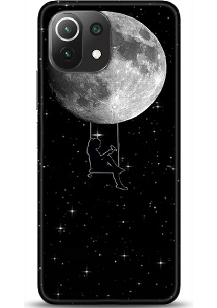 Xiaomi Mi 11 Lite Kılıf Hd Baskılı Kılıf - Followed Institution 0321