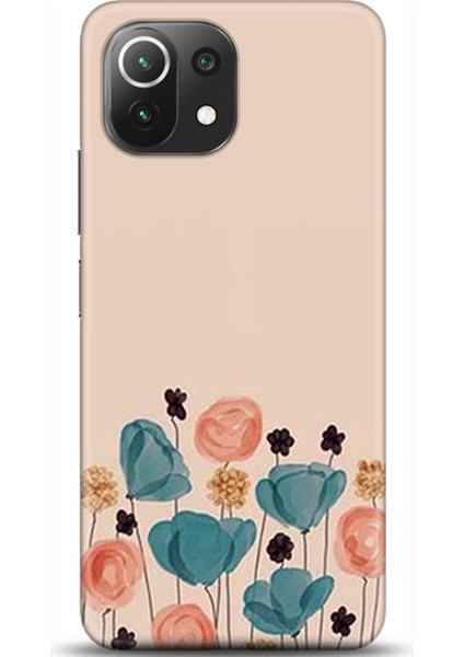 Xiaomi Mi 11 Lite Kılıf Hd Baskılı Kılıf - Followed Institution 0359