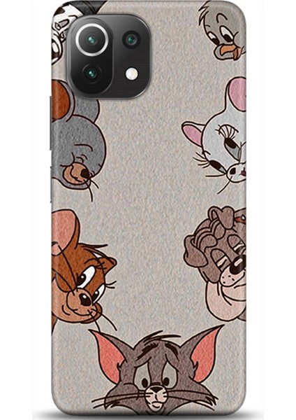 Xiaomi Mi 11 Lite Kılıf Hd Baskılı Kılıf - Followed Institution 0458