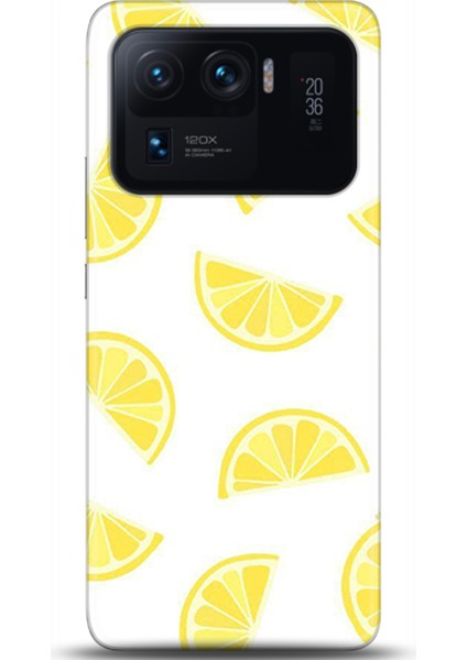 Xiaomi Mi 11 Ultra Kılıf Hd Baskılı Kılıf - Followed Institution 0105