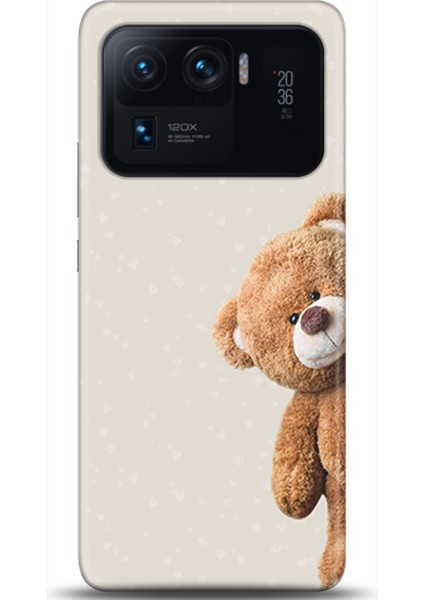 Xiaomi Mi 11 Ultra Kılıf Hd Baskılı Kılıf - Followed Institution 0005