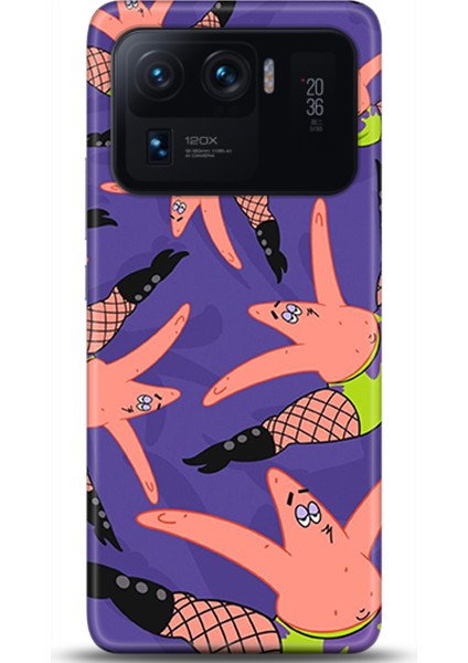 Xiaomi Mi 11 Ultra Kılıf Hd Baskılı Kılıf - Followed Institution 0566
