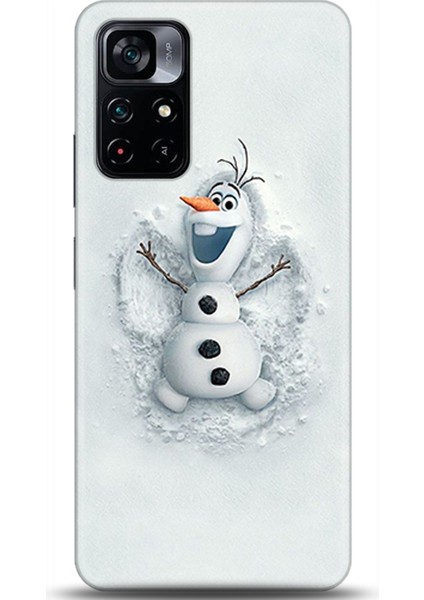 Xiaomi Poco M4 Pro 5g Kılıf Hd Baskılı Kılıf - Followed Institution 0368