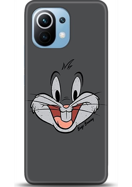 Xiaomi Mi 11 Kılıf Hd Baskılı Kılıf - Followed Institution 0006