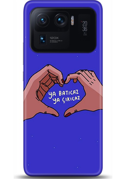 Xiaomi Mi 11 Ultra Kılıf Hd Baskılı Kılıf - Followed Institution 0562
