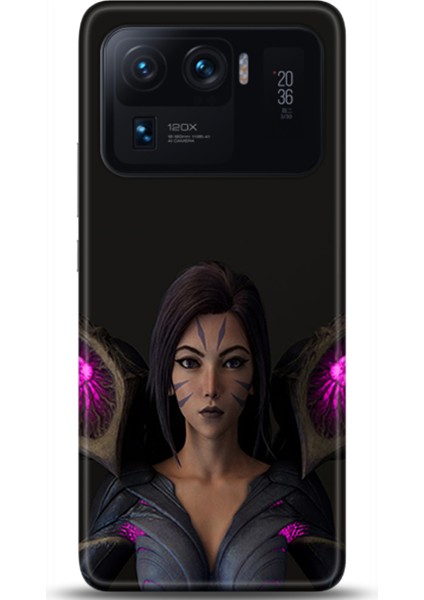 Xiaomi Mi 11 Ultra Kılıf Hd Baskılı Kılıf - Followed Institution 0108