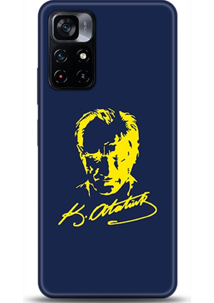 Xiaomi Poco M4 Pro 5g Kılıf Hd Baskılı Kılıf - Followed Institution 0548