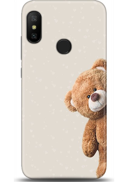 Xiaomi Mi A2 Lite Kılıf Hd Baskılı Kılıf - Followed Institution 0005