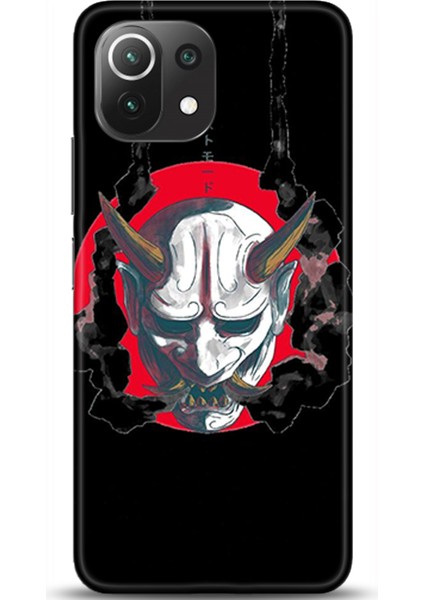 Xiaomi Mi 11 Lite Kılıf Hd Baskılı Kılıf - Followed Institution 0229