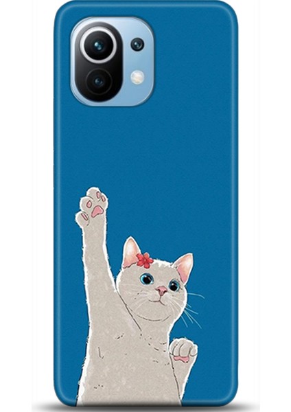 Xiaomi Mi 11 Kılıf Hd Baskılı Kılıf - Followed Institution 0026