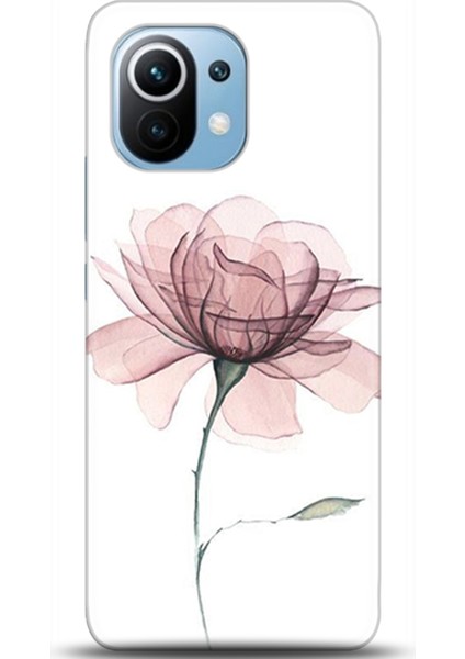 Xiaomi Mi 11 Kılıf Hd Baskılı Kılıf - Followed Institution 0309