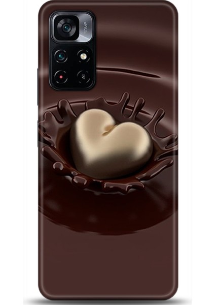 Xiaomi Poco M4 Pro 5g Kılıf Hd Baskılı Kılıf - Followed Institution 0699