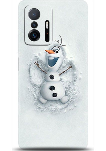 Xiaomi Mi 11T Kılıf Hd Baskılı Kılıf - Followed Institution 0368