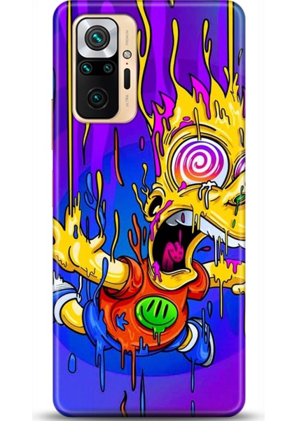 Xiaomi Redmi Note 10 Pro Kılıf Hd Baskılı Kılıf - Followed Institution 0158