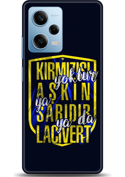 Xiaomi Redmi Note 12 Pro 5g Kılıf Hd Baskılı Kılıf - Followed Institution 0551