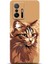 Xiaomi Mi 11T Pro Kılıf Hd Baskılı Kılıf - Followed Institution 0554 1